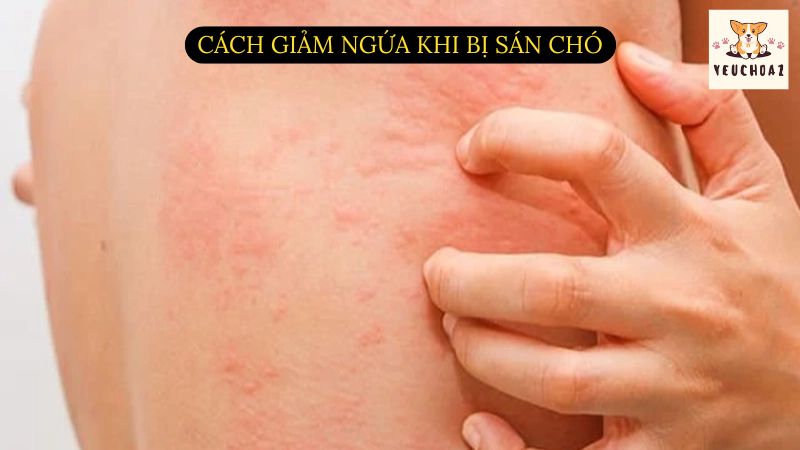 Cách giảm ngứa khi bị sán chó